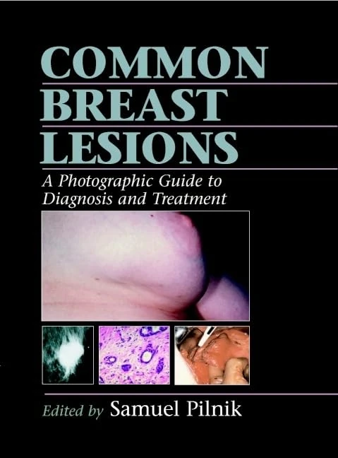 Common Breast Lesions: A Photographic Guide to Diagnosis and Treatment