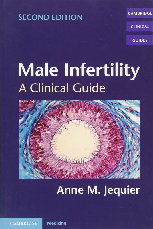 Male Infertility: A Clinical Guide (Cambridge Clinical Guides)