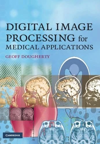 Digital Image Processing for Medical Applications