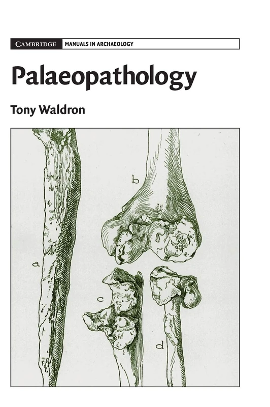 Palaeopathology (Cambridge Manuals in Archaeology)