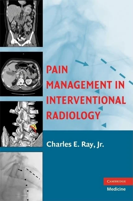Pain Management in Interventional Radiology - Image 1