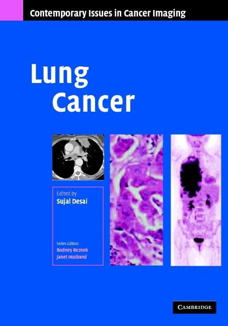 Lung Cancer (Contemporary Issues in Cancer Imaging)