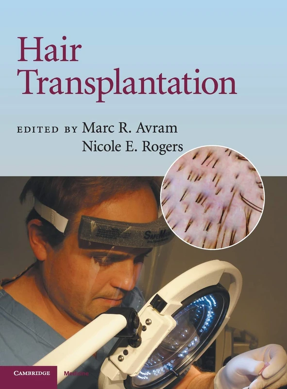 Hair Transplantation (Cambridge Medicine (Hardcover))