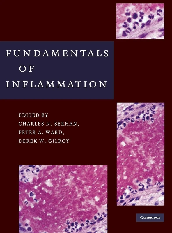 Fundamentals of Inflammation