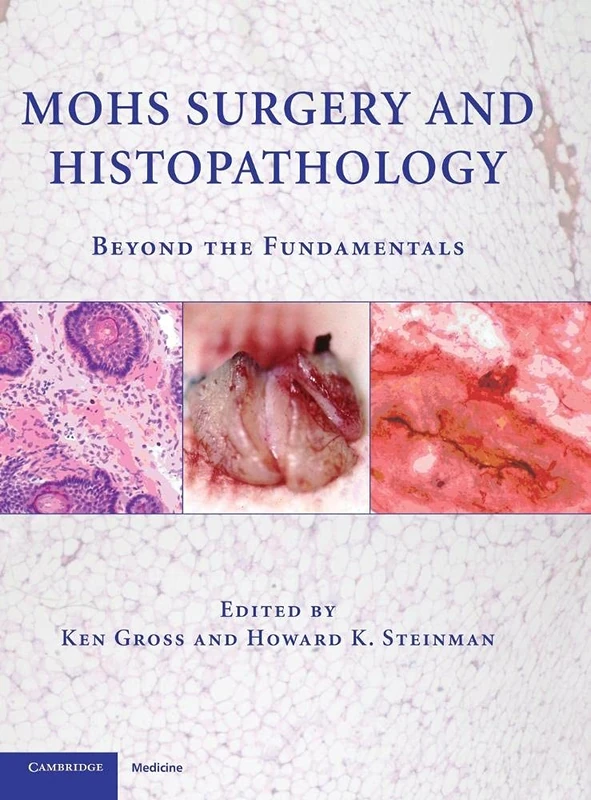 Mohs Surgery and Histopathology: Beyond the Fundamentals - Image 1
