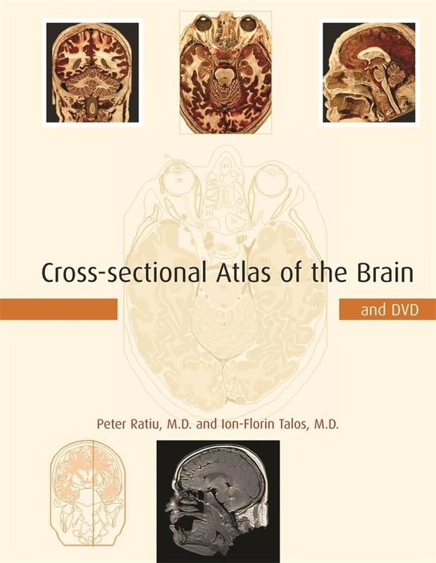 Cross-Sectional Atlas of the Human Brain