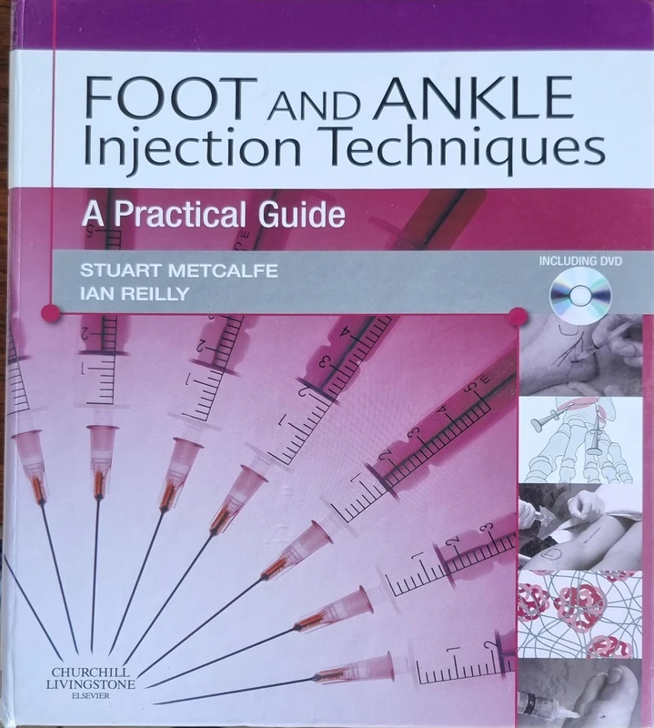 Foot and Ankle Injection Techniques: A Practical Guide