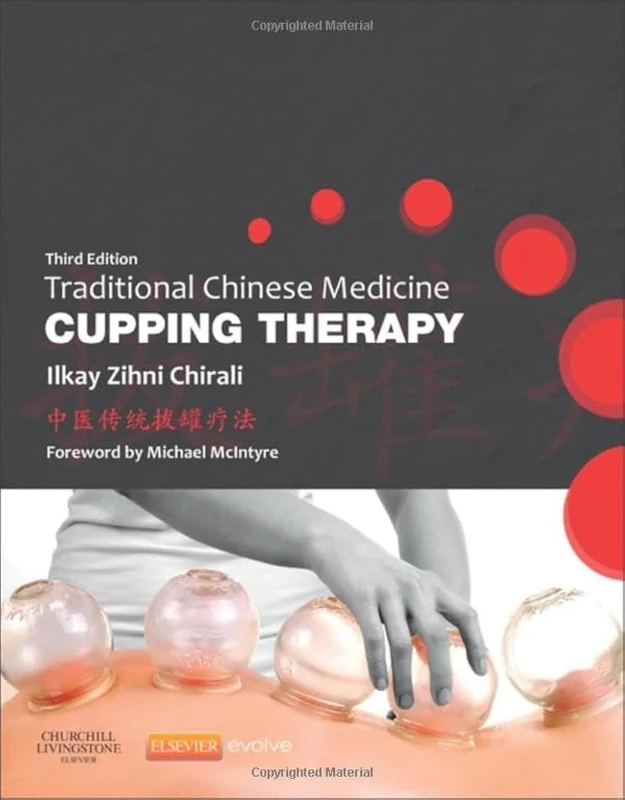 Traditional Chinese Medicine Cupping Therapy