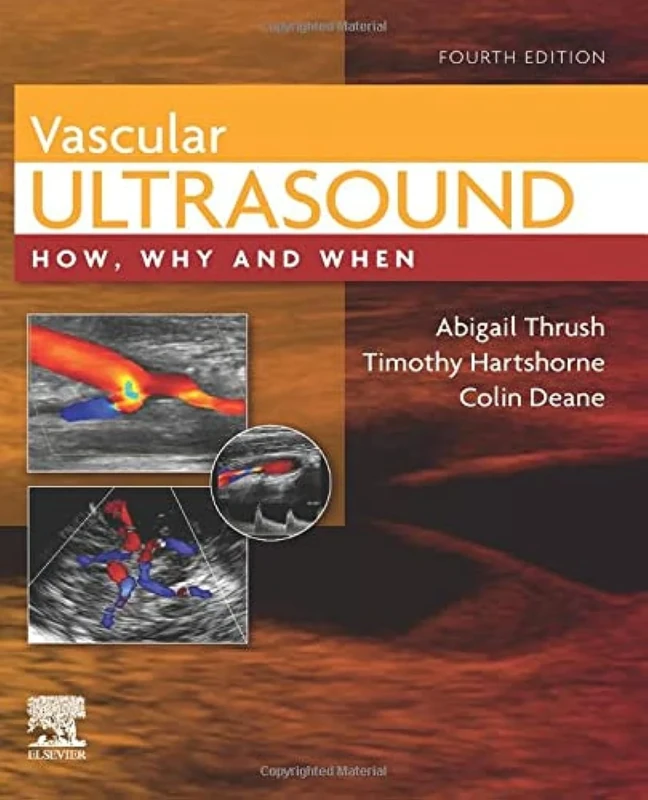 Vascular Ultrasound: How, Why and When
