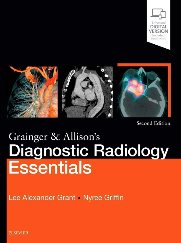 Grainger & Allison's Diagnostic Radiology Essentials: Expert Consult: Online and Print