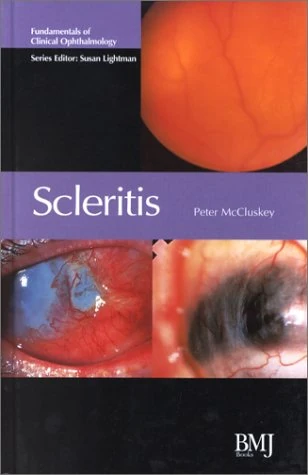 Scleritis: Fundamentals of Clinical Ophthalmology (Fundamentals of Clinical Opthalmology)