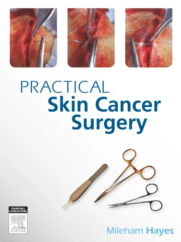 Practical Skin Cancer Surgery