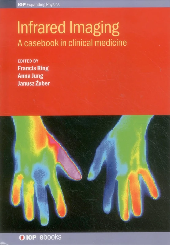 Infrared Imaging: A Casebook in Clinical Medicine (IOP Expanding Physics)
