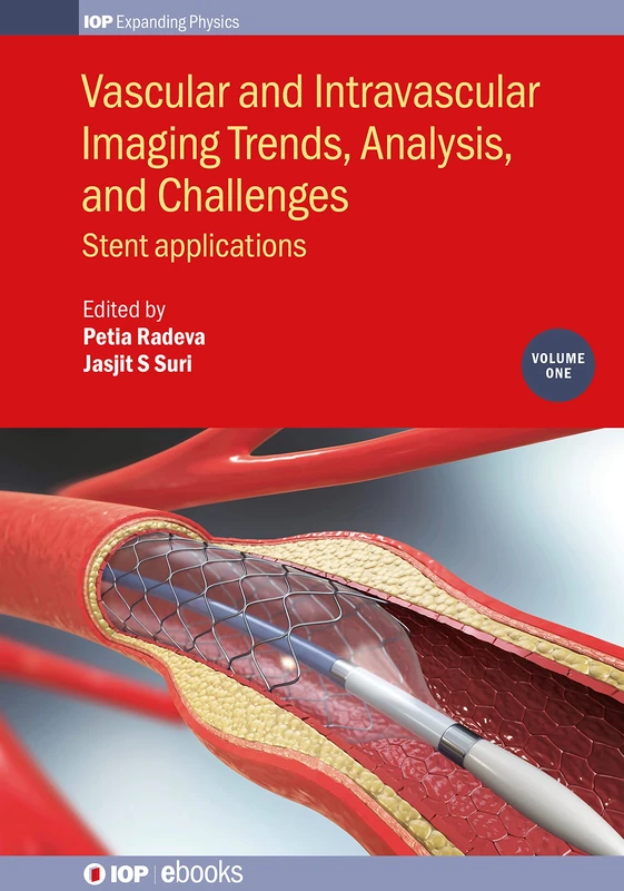 Vascular and Intravascular Imaging Trends, Analysis, and Challenges, Volume 1: Stent applications (IOP Expanding Physics)