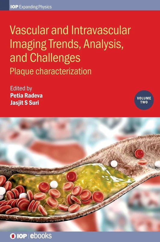 Vascular and Intravaslcular Imaging Trends, Analysis, and Challenges - Volume 2: Plaque characterization (IOP Expanding Physics)