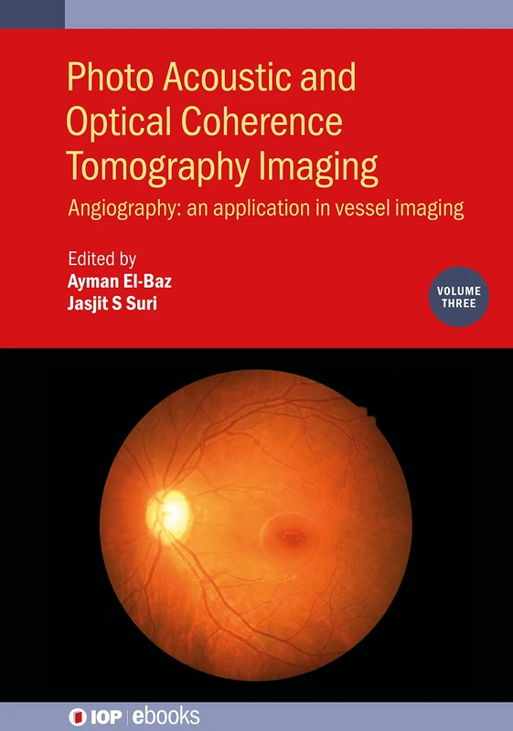 Photo Acoustic and Optical Coherence Tomography Imaging Volume 3: Angiography: - An Application in Vessel Imaging (IOP Expanding Physics) (IOP ebooks)