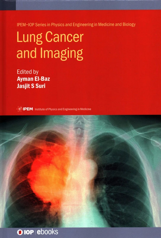 Lung Cancer and Imaging (IPEM-IOP Series in Physics and Engineering in Medicine and Biology)
