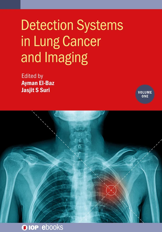 Detection Systems in Lung Cancer and Imaging, Volume 1 (IOP ebooks)