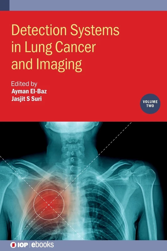 Detection Systems in Lung Cancer and Imaging, Volume 2 (IOP ebooks)