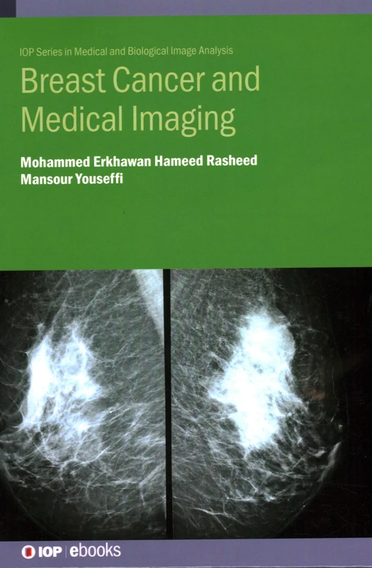 Breast Cancer and Medical Imaging - IOP Series Book