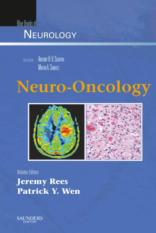 Neuro-Oncology: Blue Books of Neurology Series: Volume 36