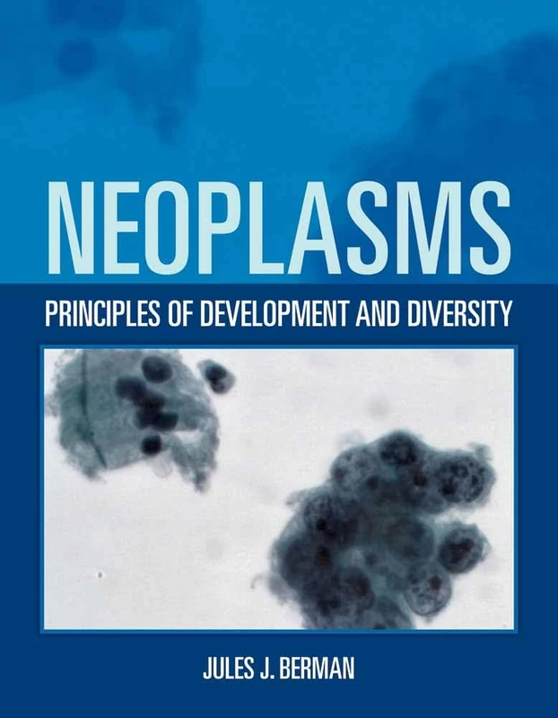 Neoplasms: Principles of Development and Diversity - Image 1