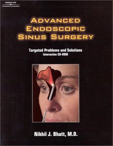 Advanced Endoscopic Sinus Surgery:: Targeted Problems and Solutions on CD-Rom
