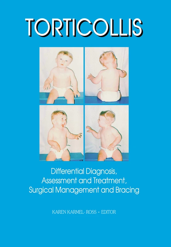 Torticollis: Differential Diagnosis, Assessment and Treatment, Surgical Management and Bracing (Physical & Occupational Therapy in Pediatrics, V. 17, No. 2)