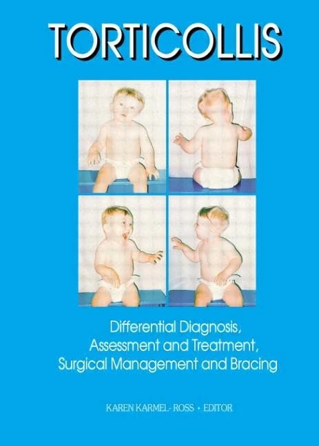 Torticollis: Differential Diagnosis, Assessment and Treatment, Surgical Management and Bracing: 17 (Haworth Social Work Practice)
