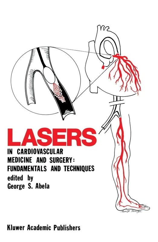 Lasers in Cardiovascular Medicine and Surgery: Fundamentals and Techniques: 103 (Developments in Cardiovascular Medicine, 103)