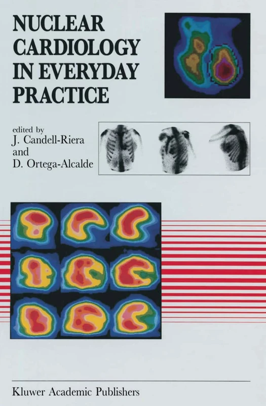 Nuclear Cardiology in Everyday Practice: 146 (Developments in Cardiovascular Medicine, 146)