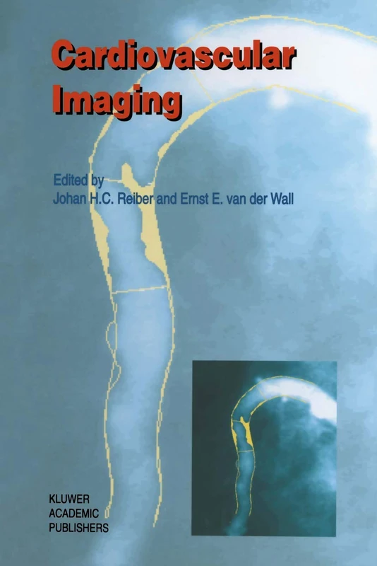 Cardiovascular Imaging: 186 (Developments in Cardiovascular Medicine, 186)