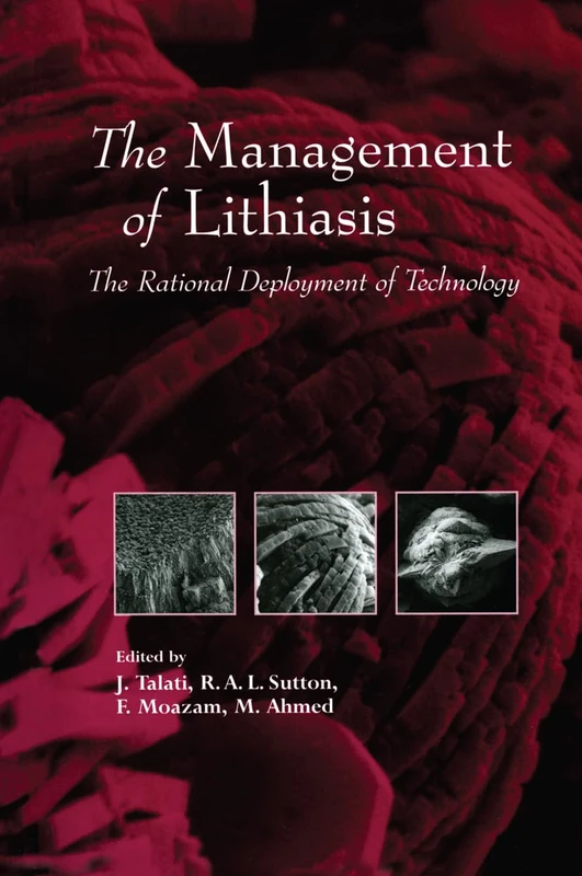 The Management of Lithiasis: The Rational Deployment of Technology: v. 38 (Developments in Nephrology)