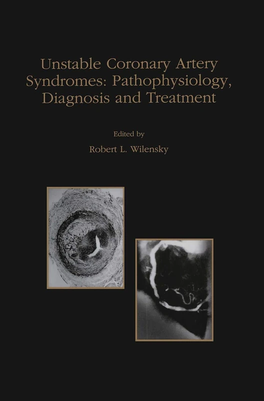 Unstable Coronary Artery Syndromes Pathophysiology, Diagnosis and Treatment: 203 (Developments in Cardiovascular Medicine, 203)
