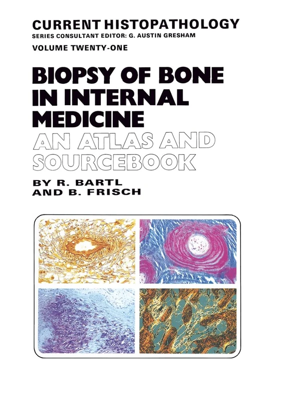 Biopsy of Bone in Internal Medicine: An Atlas and Sourcebook: v. 21 (Current Histopathology)