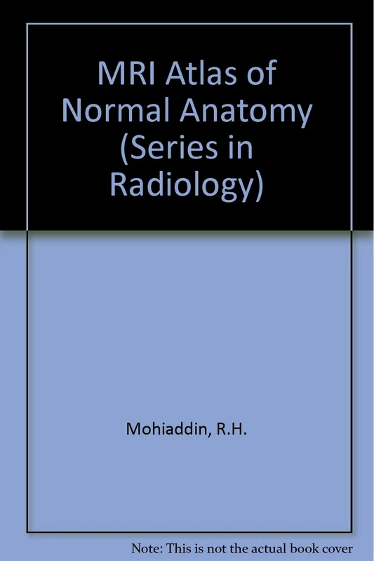 MRI Atlas of Normal Anatomy: v. 24 (Series in Radiology)