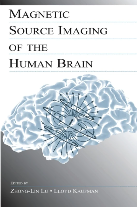 Magnetic Source Imaging of the Human Brain