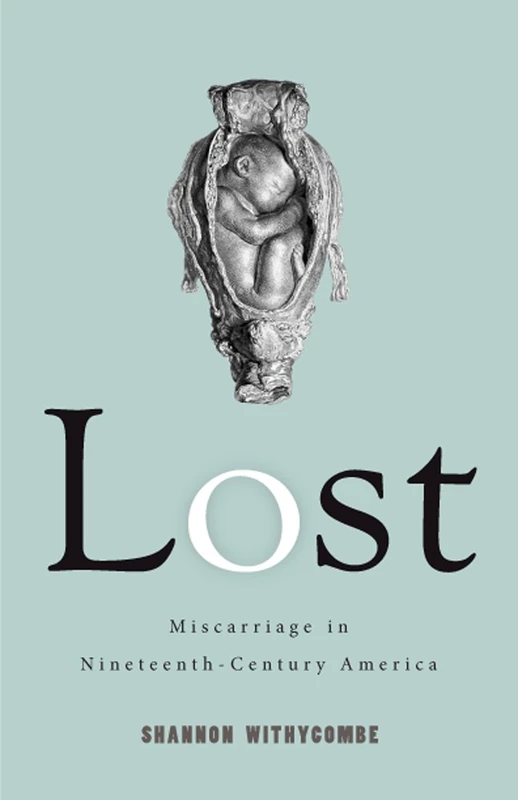 Lost: Miscarriage in 19th-Century America - Rutgers Press