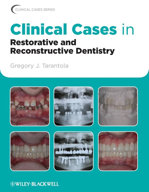Clinical Cases in Restorative and Reconstructive Dentistry: 41 (Clinical Cases (Dentistry))