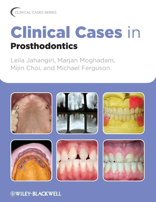 Clinical Cases in Prosthodontics: 9 (Clinical Cases (Dentistry))
