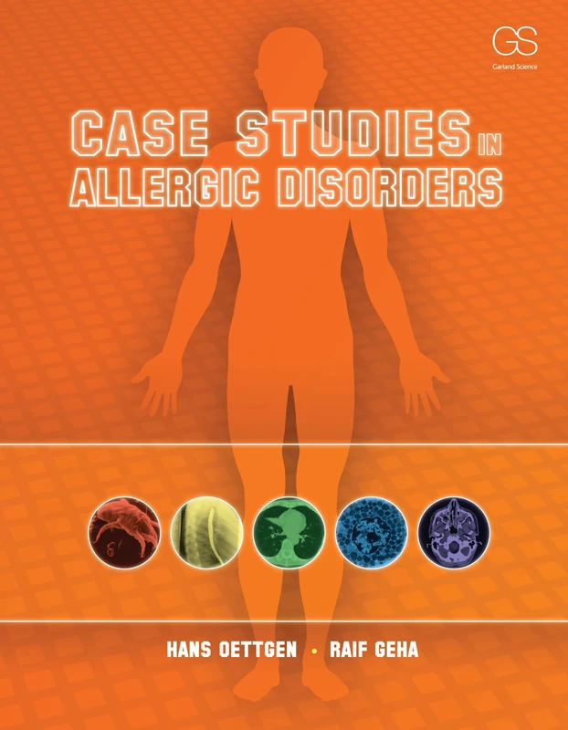 Case Studies in Allergic Disorders