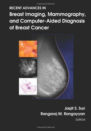 Recent Advances in Breast Imaging, Mammography, and Computer-aided Diagnosis of Breast Cancer (Press Monograph)
