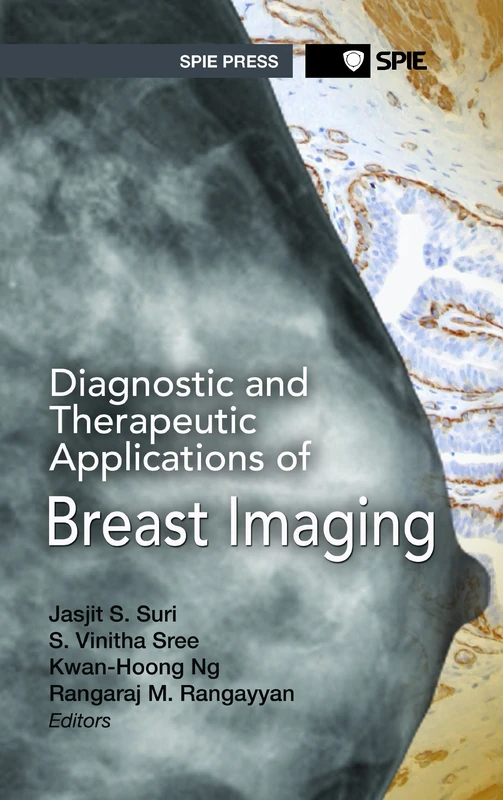 Diagnostic and Therapeutic Applications of Breast Imaging (SPIE Press Monograph)
