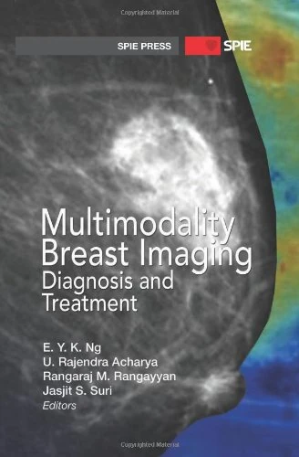 Multimodality Breast Imaging: Diagnosis and Treatment Book