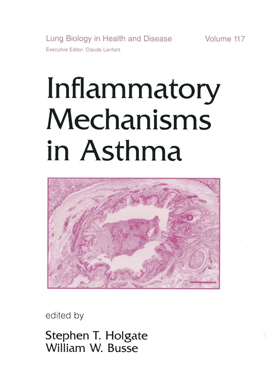 Inflammatory Mechanisms in Asthma: 117 (Lung Biology in Health and Disease)