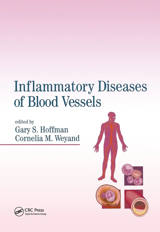 Inflammatory Diseases of Blood Vessels
