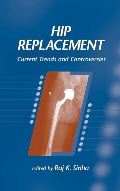 Hip Replacement: Current Trends and Controversies