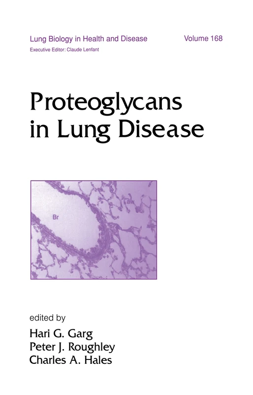 Proteoglycans in Lung Disease: 168 (Lung Biology in Health and Disease)