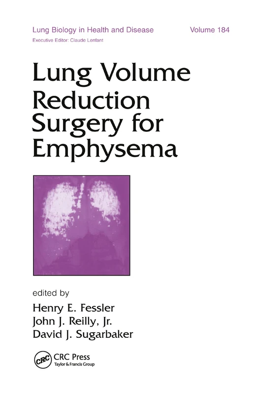 CRC Press Lung Volume Reduction Surgery for Emphysema 184