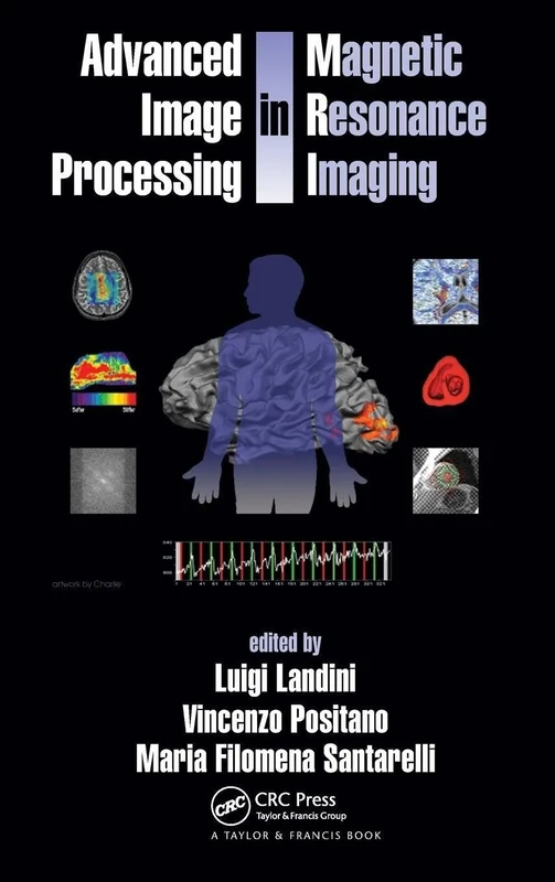 Advanced Image Processing in Magnetic Resonance Imaging: 27 (Signal Processing and Communications)
